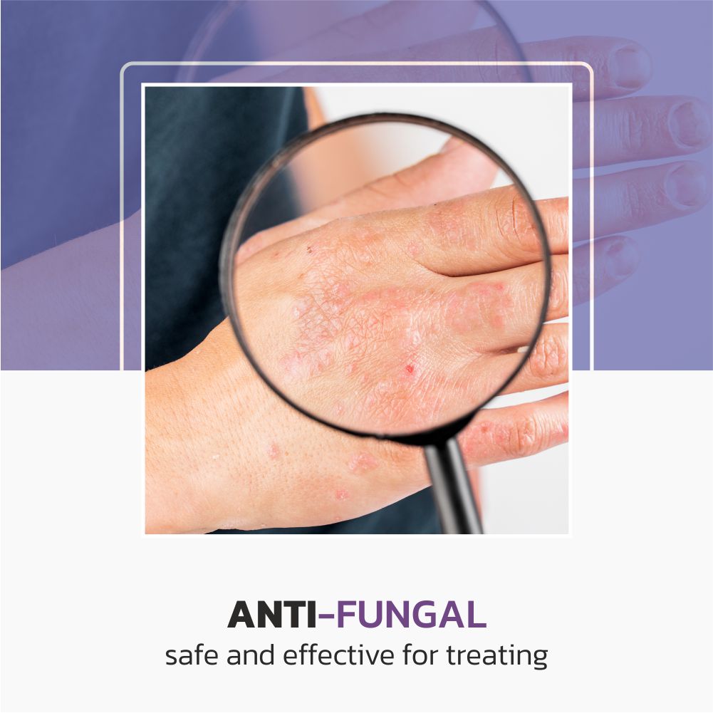 Anti-fungal