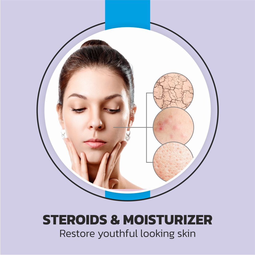 Steroids & Moisturizer