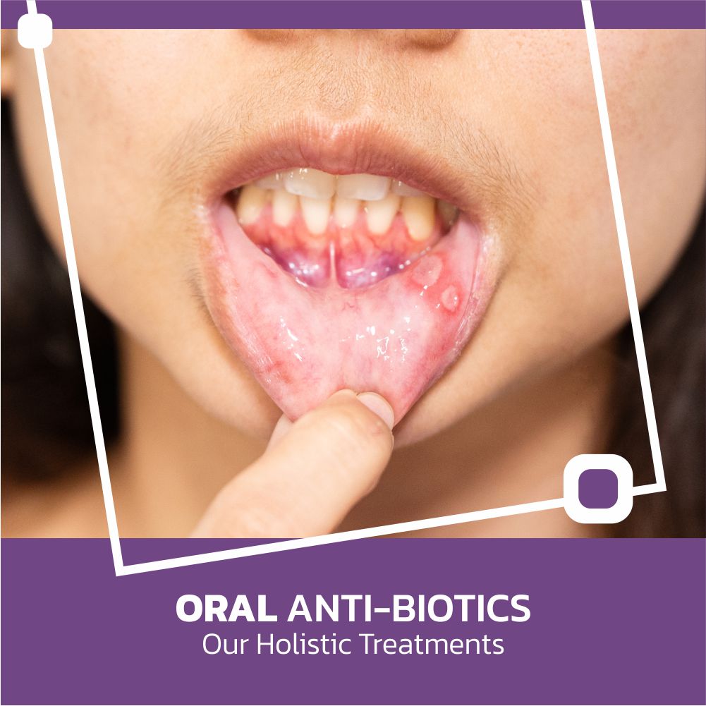 Anti-biotics