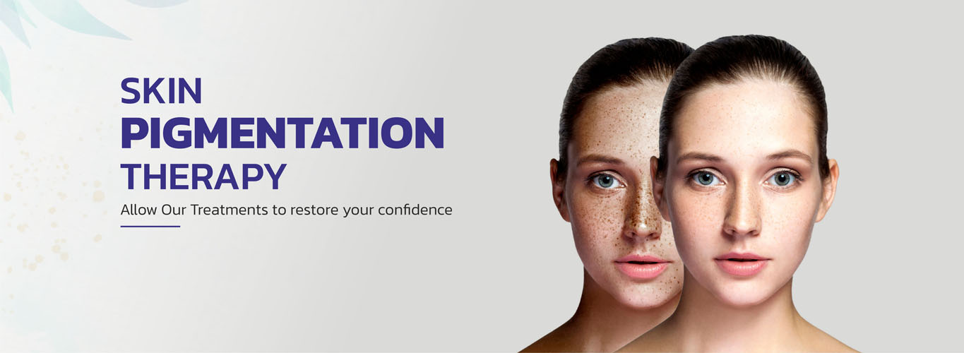 Skin Pigmentation